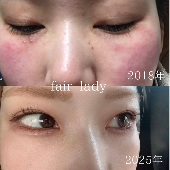 Fair lady施術イメージ